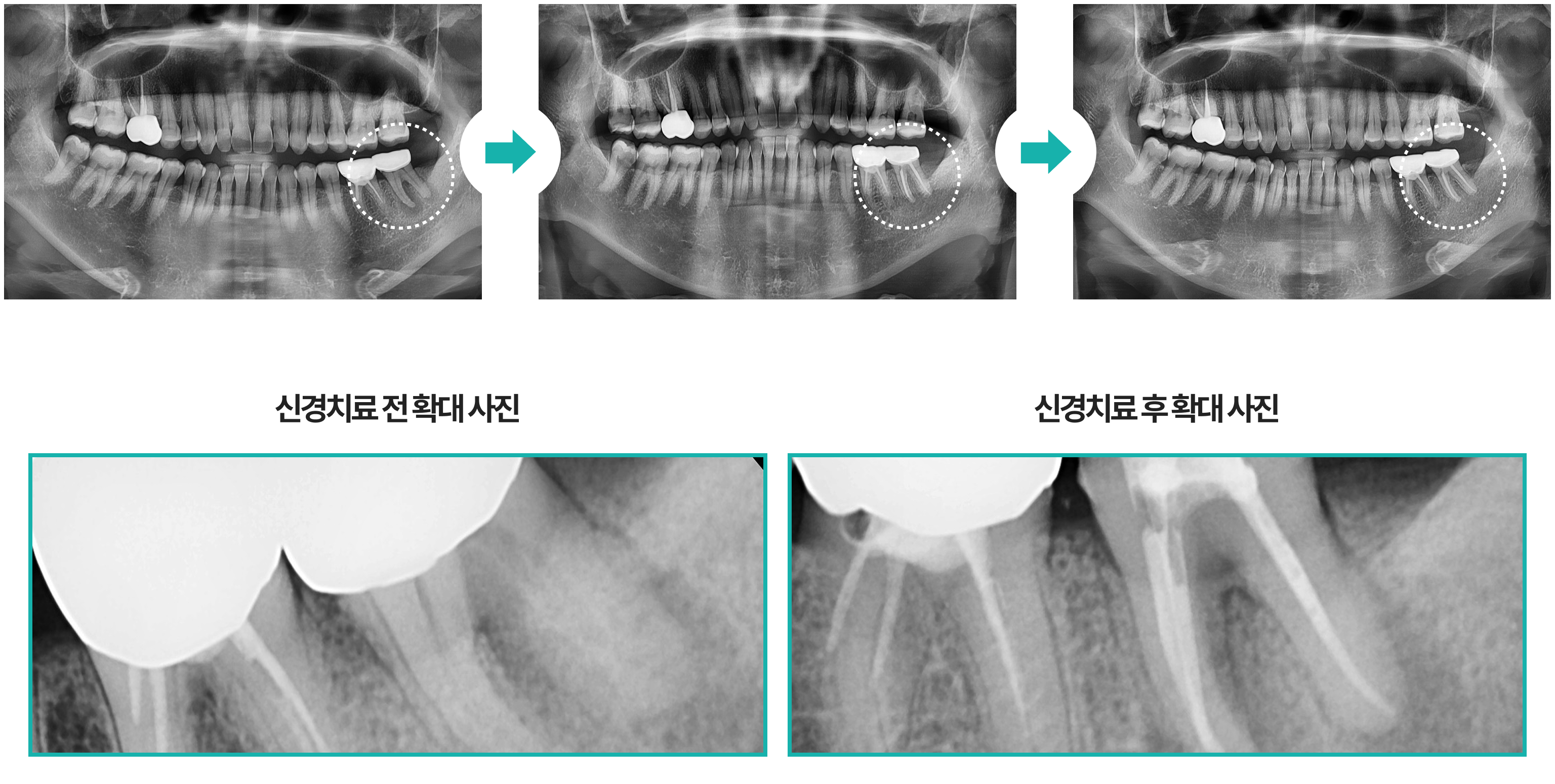 실제 환자 치료 과정